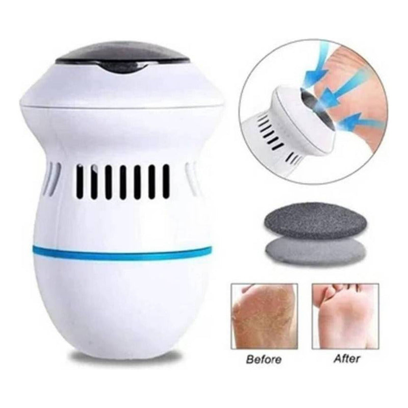 Maquina Callo Pulidor De Pies Electrico Pedicure Recargable