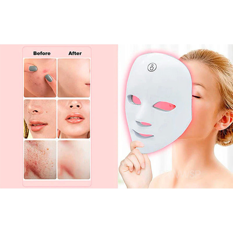 Máscara De Terapia De Luz Facial Led 7 Colores Fototerapia Normal