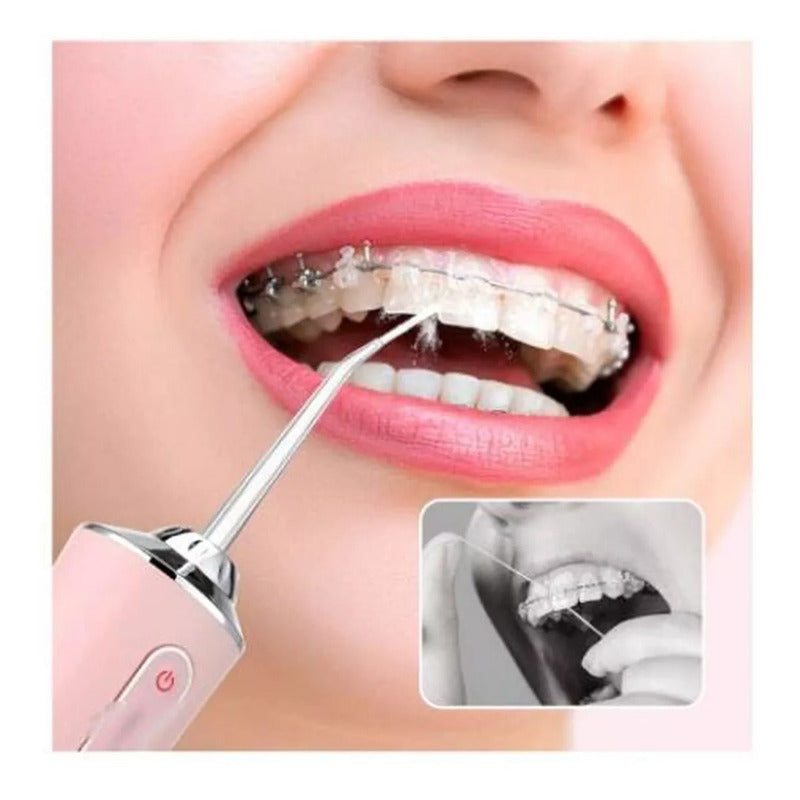 Irrigador Bucal Portátil Higiene Dental Limpiador  Variados