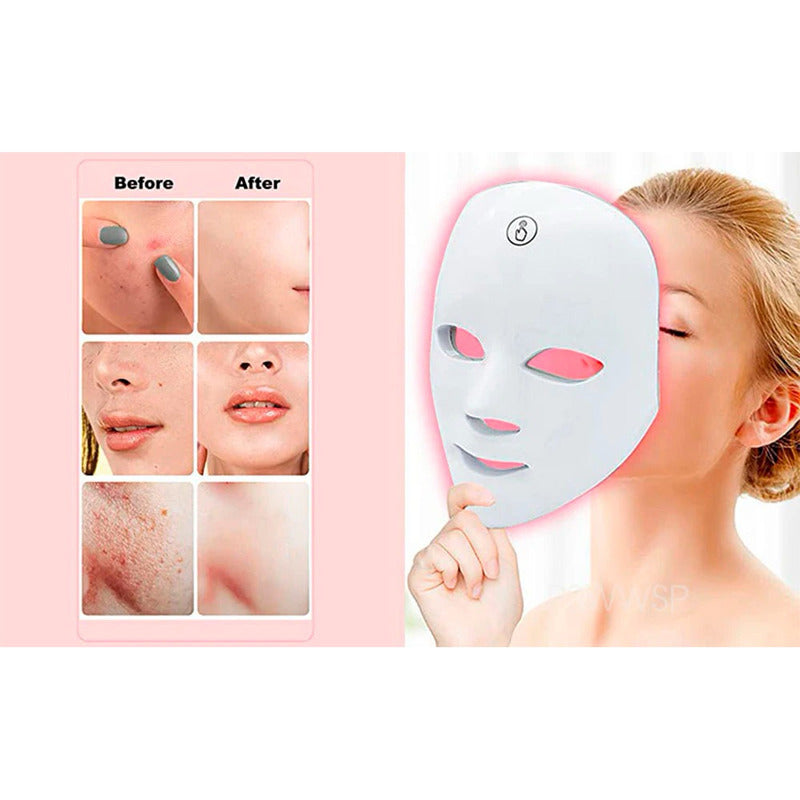 Máscara De Terapia De Luz Facial Led 7 Colores Fototerapia