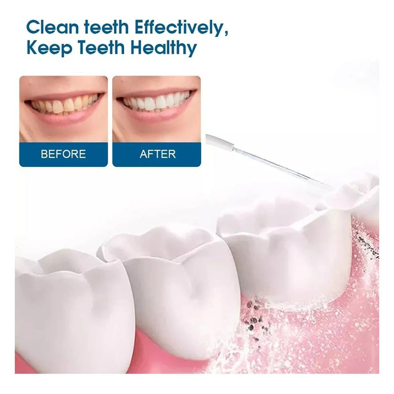 Irrigador Bucal Portátil Higiene Dental Limpiador  Variados